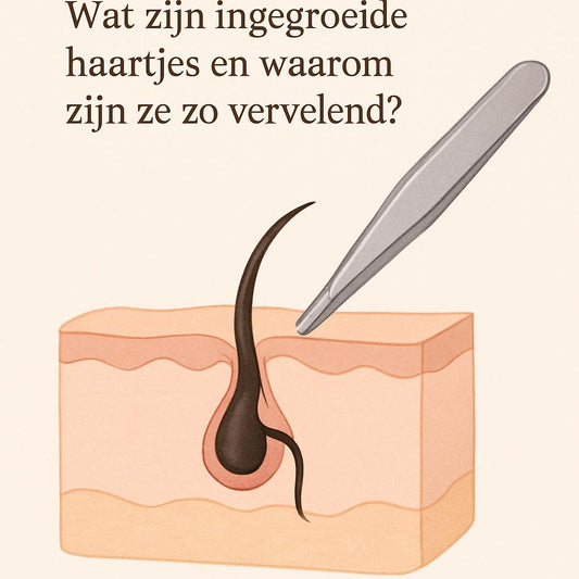 Daarom is de CSN Tweezer ideaal bij ingegroeide haartjes